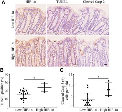 Hypoxic Cell-Derived Extracellular Vesicles Aggravate Rectal Injury Following Radiotherapy via MiR-122-5p